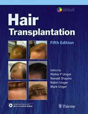 Hair Transplantation 5th