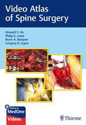 Video Atlas of Spine Surgery 1st