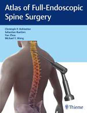 Atlas of Full-Endoscopic Spine Surgery 1st