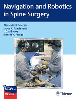 Navigation and Robotics in Spine Surgery  1st