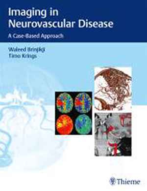 Imaging in Neurovascular Disease: A Case-Based Approach 1st