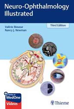 Neuro-Ophthalmology Illustrated  3rd