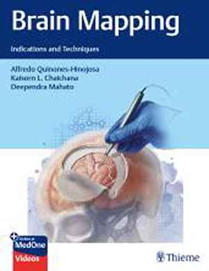 Brain Mapping: Indications and Techniques  1st