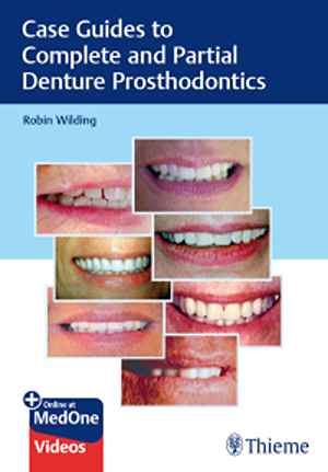 Case Guides to Complete and Partial Denture Prosthodontics 1st
