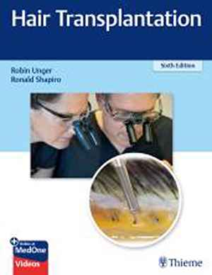 Hair Transplantation 6th