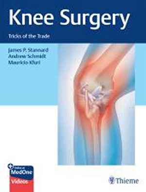 Knee Surgery: Tricks of the Trade  1st