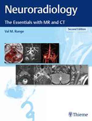 Neuroradiology: The Essentials with MR and CT  2nd