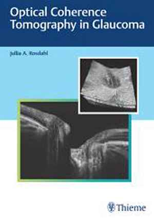 Optical Coherence Tomography in Glaucoma 1st