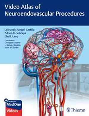 Video Atlas of Neuroendovascular Procedures  1st