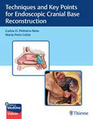 Techniques and Key Points for Endoscopic Cranial Base Reconstruction 1st