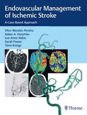 Endovascular Management of Ischemic Stroke: A Case-Based Approach 1st