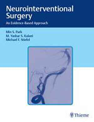 Neurointerventional Surgery: An Evidence-Based Approach  1st