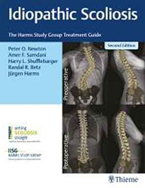 Idiopathic Scoliosis: The Harms Study Group Treatment Guide  2nd