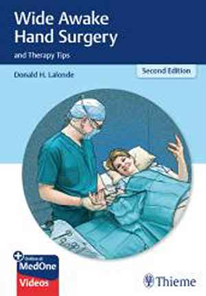 Wide Awake Hand Surgery and Therapy Tips 2nd