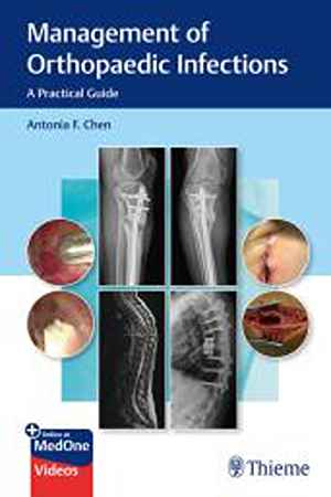 Management of Orthopaedic Infections: A Practical Guide  1st