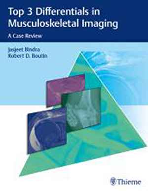 Top 3 Differentials in Musculoskeletal Imaging: A Case Review  1st