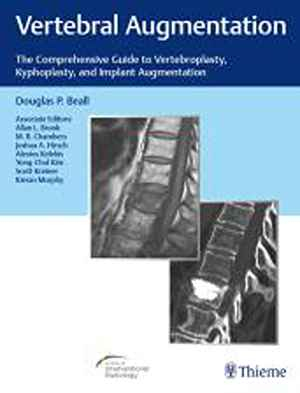 Vertebral Augmentation: The Comprehensive Guide to Vertebroplasty, Kyphoplasty, and Implant Augmentation  1st