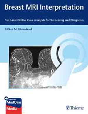 Breast MRI Interpretation: Text and Case Analysis for Screening and Diagnosis 1st