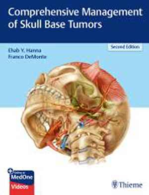 Comprehensive Management of Skull Base Tumors 2nd