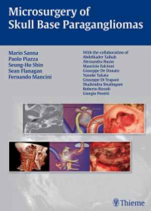 Microsurgery of Skull Base Paragangliomas  1st