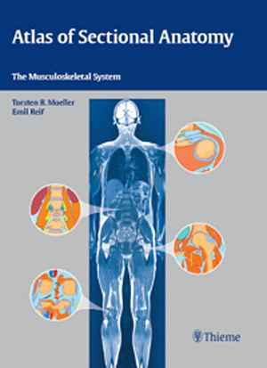 Atlas of Sectional Anatomy: The Musculoskeletal System  1st
