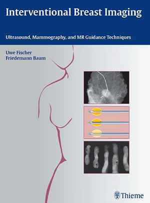 Interventional Breast Imaging: Ultrasound, Mammography, and MR Guidance Techniques 1st