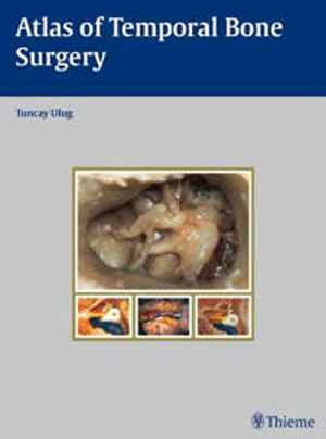 Atlas of Temporal Bone Surgery  1st