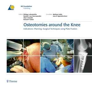 Osteotomies around the Knee: Indications - Planning - Surgical Techniques using Plate Fixators  1st