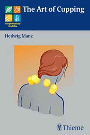 Art of Cupping  1st