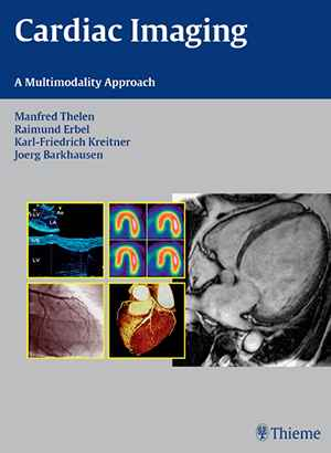 Cardiac Imaging: A Multimodality Approach  1st
