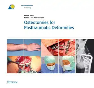 Osteotomies for Posttraumatic Deformities  1st