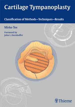 Cartilage Tympanoplasty: Classification of Methods - Techniques - Results 1st