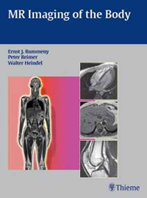 MR Imaging of the Body  1st