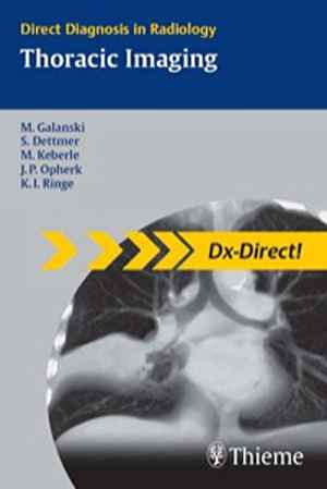 Thoracic Imaging 1st