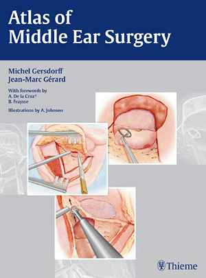 Atlas of Middle Ear Surgery 1st