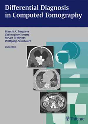 Differential Diagnosis in Computed Tomography  2nd