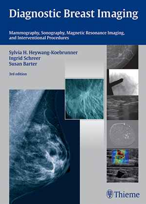 Diagnostic Breast Imaging: Mammography, Sonography, Magnetic Resonance Imaging, and Interventional Procedures  3rd
