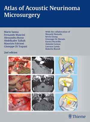 Atlas of Acoustic Neurinoma Microsurgery 2nd