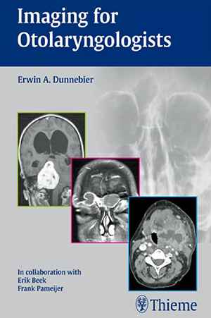 Imaging for Otolaryngologists 1st