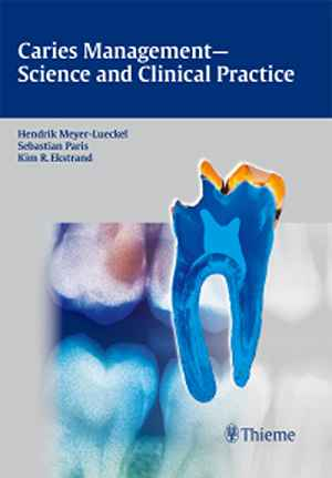 Caries Management - Science and Clinical Practice  1st