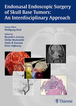 Endonasal Endoscopic Surgery of Skull Base Tumors: An Interdisciplinary Approach 1st