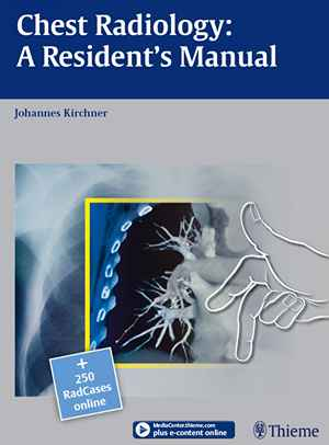 Chest Radiology: A Resident's Manual 1st