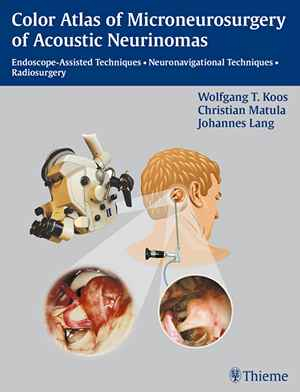 Color Atlas of Microsurgery of Acoustic Neurinomas: Endoscope-Assisted Techniques - Neuronavigational Techniques - Radiosurgery  1st
