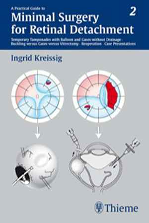Practical Guide to Minimal Surgery for Retinal Detachment, Volume II  1st