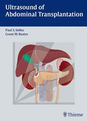 Ultrasound of Abdominal Transplantation  1st