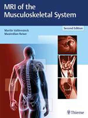 MRI of the Musculoskeletal System 2nd