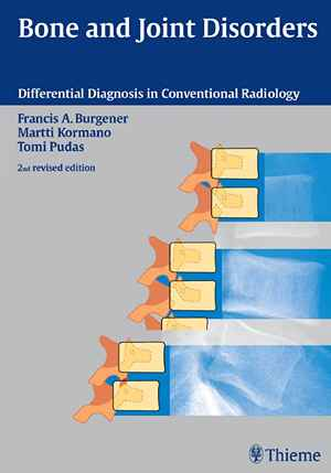 Bone and Joint Disorders  2nd