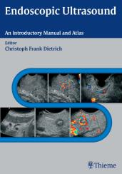 Endoscopic Ultrasound: An Introductory Manual and Atlas 1st
