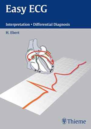 Easy ECG: Interpretation - Differential Diagnosis 1st
