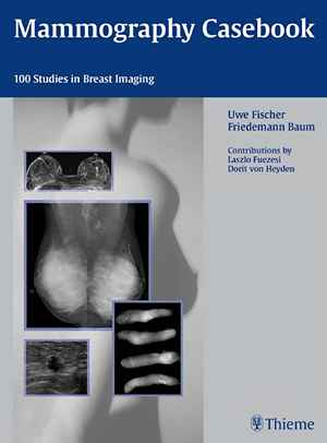Mammography Casebook: 100 Studies in Breast Imaging  1st
